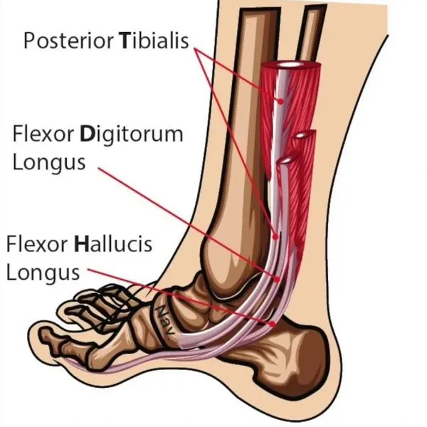 Posterior tibialis tendon dysfunction (PTTD) | Gen Physio